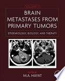 Brain metastases from primary tumors