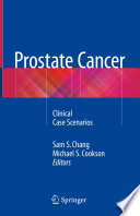 Prostate cancer : clinical case scenarios /