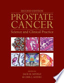 Prostate cancer : science and clinical practice /