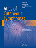 Atlas of cutaneous lymphomas : classification and differential diagnosis /