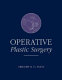 Operative plastic surgery /