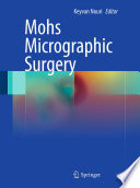 Mohs micrographic surgery /