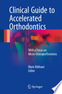 Clinical guide to accelerated orthodontics : with a focus on micro-osteoperforations /