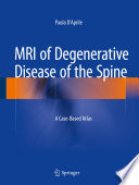 MRI of degenerative disease of the spine : a case-based atlas /
