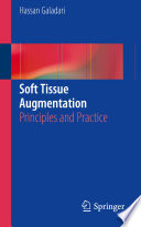 Soft tissue augmentation : principles and practice /