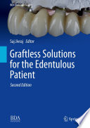 Graftless Solutions for the Edentulous Patient