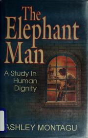 The elephant man : a study in human dignity /