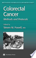 Colorectal Cancer : Methods and Protocols /