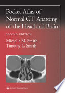 Pocket atlas of normal CT anatomy of the head and brain /