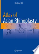 Atlas of Asian rhinoplasty /